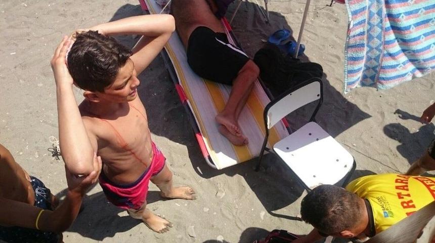 Denize Atlayan Gencin Başı Yarıldı