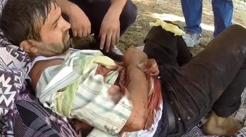 Otlattığı Boğanın Boynuz Darbeleriyle Yaralandı