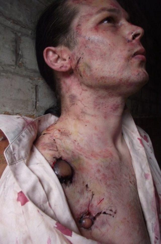 Sizi 24 Saatte &Ouml;ld&uuml;rebilecek Hastalıklar (+18) 2