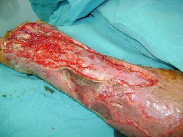 Sizi 24 Saatte &Ouml;ld&uuml;rebilecek Hastalıklar (+18) 5