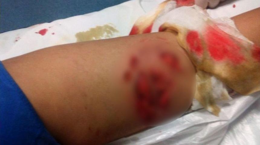 Eskişehir&rsquo;de K&ouml;pek Dehşeti