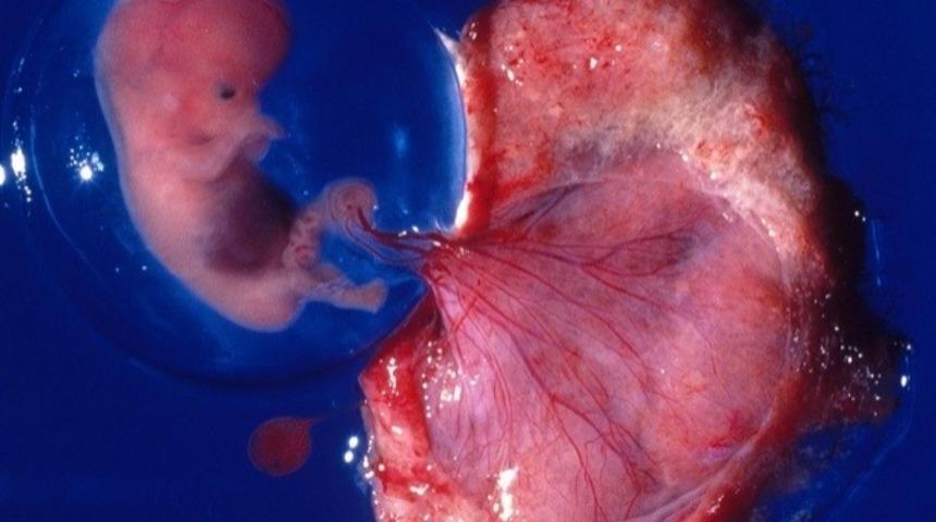 Bir Hollywood Yamyamlığı: Plasenta Yemek!