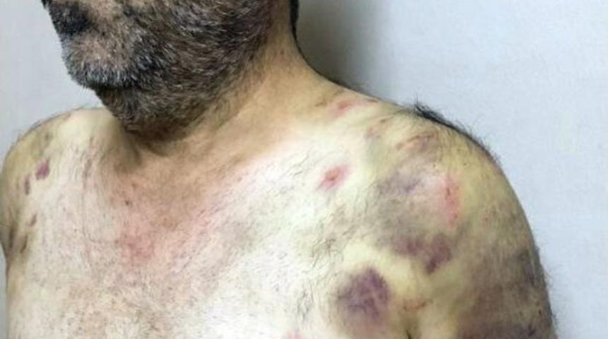 İstanbul’da Fidye Operasyonu