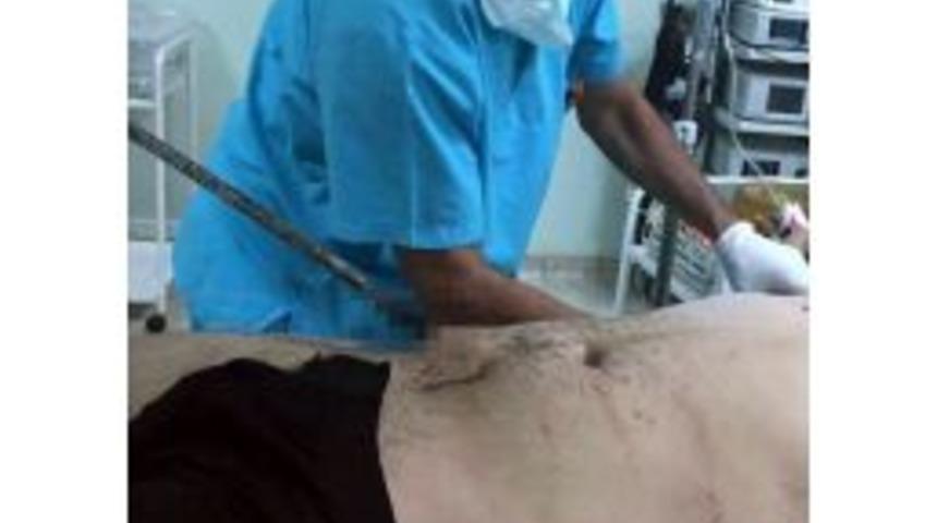 Karnına Saplanan Bir Metre Demir &Ccedil;ubukla Hastaneye Getirildi