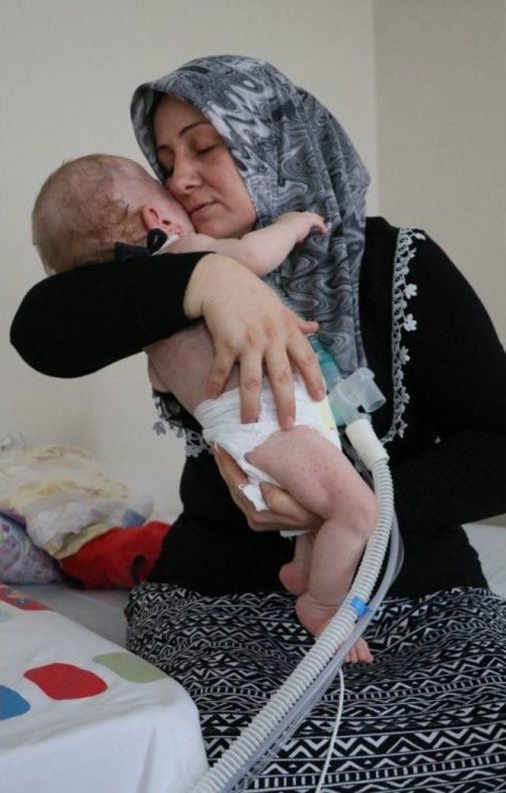 (özel Haber) 15 Aylık Umut Bebeğin Yaşam Savaşı G1