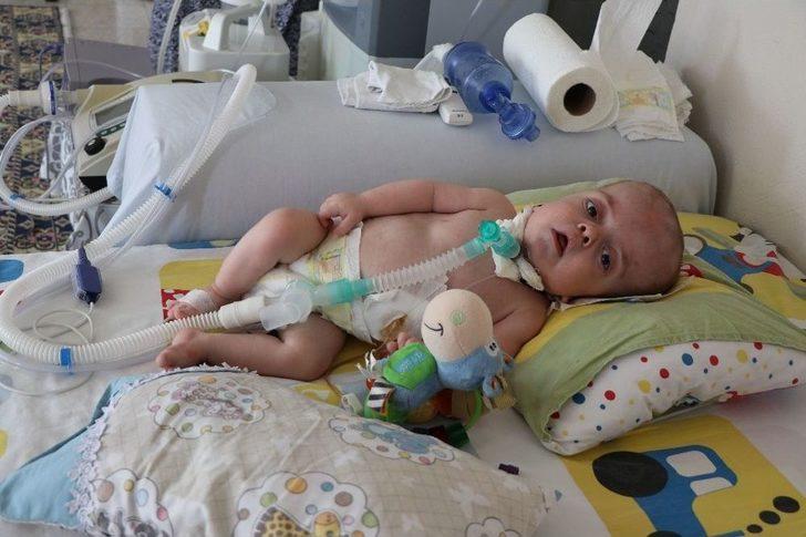 (özel Haber) 15 Aylık Umut Bebeğin Yaşam Savaşı G4