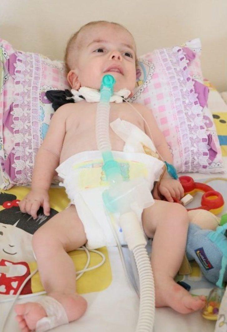 (özel Haber) 15 Aylık Umut Bebeğin Yaşam Savaşı G5