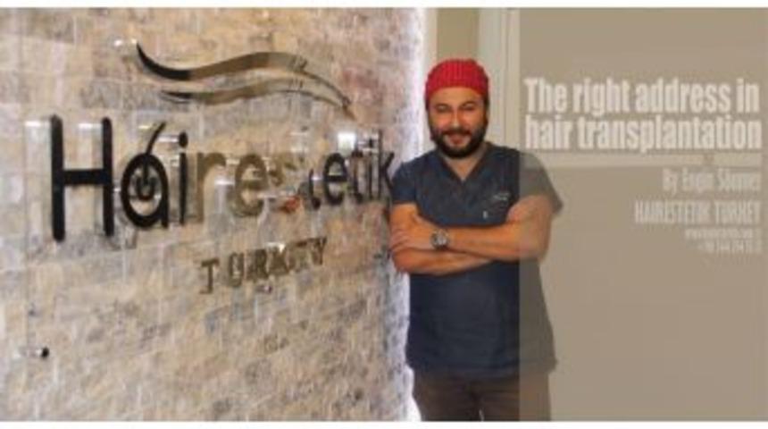 Sa&ccedil; Ekiminde Başarıyı Etkileyen Fakt&ouml;rlere Dikkat !