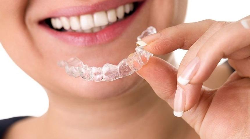 Invisalign Tedavisi Hakkında Bilinmesi Gereken 12 Nokta
