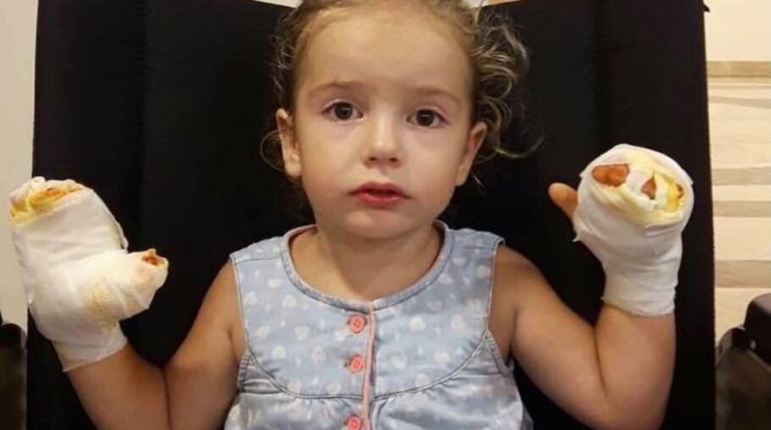 İ&ccedil;inde Yanıcı Gaz Bulunan U&ccedil;an Balon K&uuml;&ccedil;&uuml;k Kızı Yaktı