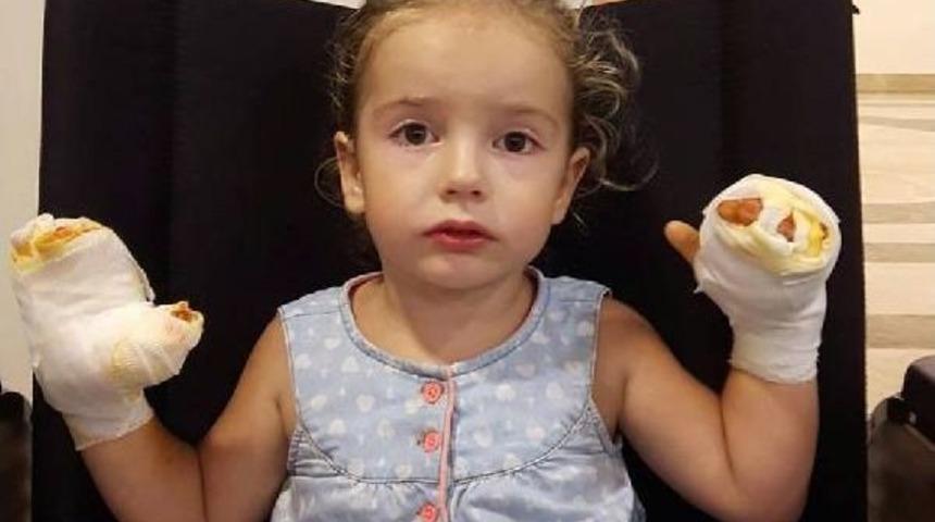 Patlayan U&ccedil;an Balon, Minik Mira'nın Ellerini Yaktı, Annesi Isyan Etti