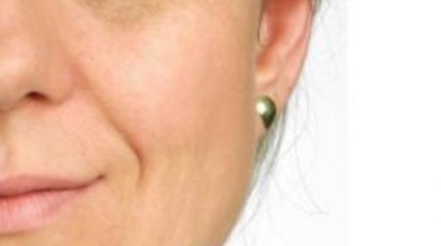 Sarkık G&ouml;z Kapağı Yorgunluk Sebebi