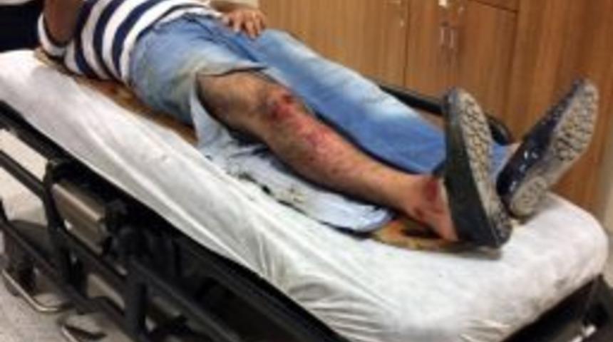 Polisin Yakaladığı Şahıs Kazaya Neden Oldu: 1&rsquo;i Polis 2 Yaralı