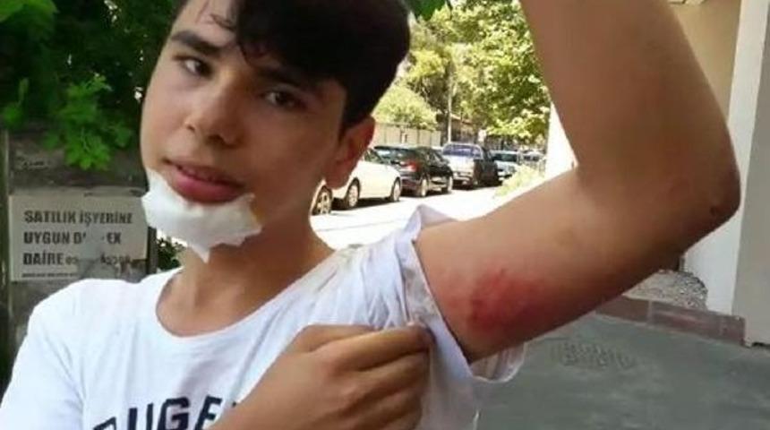 A&ccedil;ık Bırakılan R&ouml;gara D&uuml;şen Gen&ccedil; Yaralandı