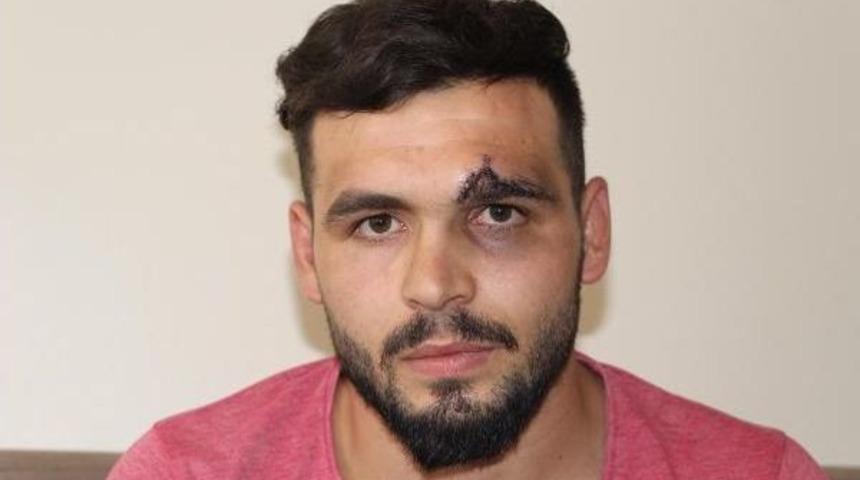 D&uuml;ğ&uuml;nde Ters Takla Atarken Yere &Ccedil;akıldı, Kaşına 22 Dikiş Atıldı