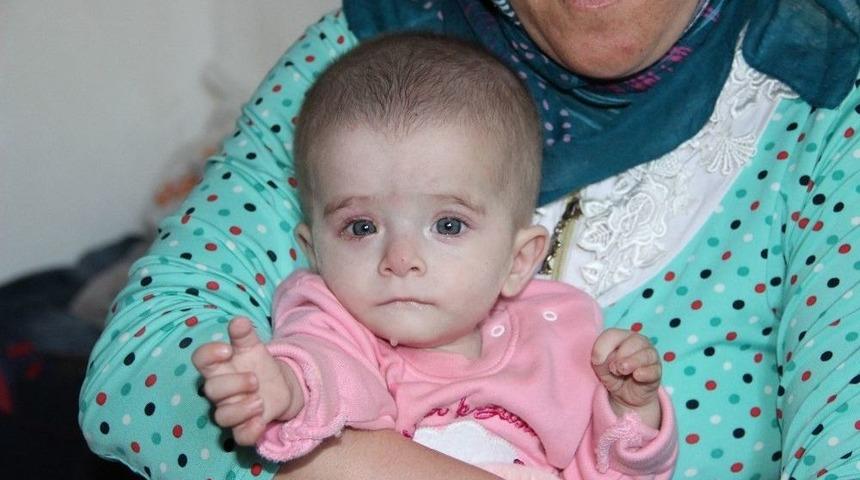 Kanser Hastası 10 Aylık Alime&rsquo;nin Bakışları Y&uuml;rek Yakıyor