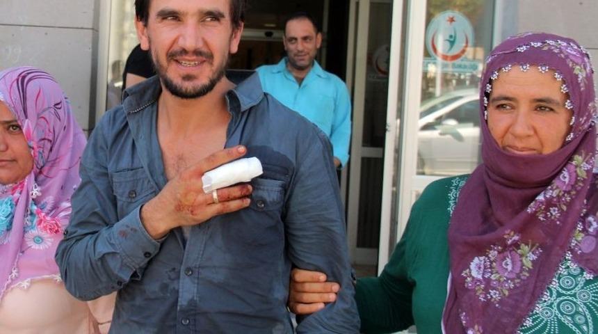 Acemi Kasaplar Kendini Kesti