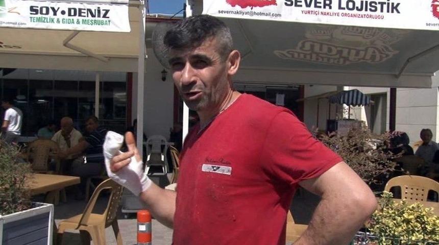 Kendini Kesen Acemi Kasaplar Hastaneye Akın Etti