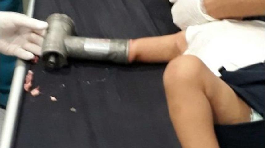 2 Yaşındaki &Ccedil;ocuk Elini Kıyma Makinesine Kaptırdı