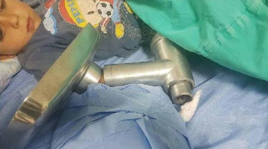 K&uuml;&ccedil;&uuml;k &Ccedil;ocuk Elini Kıyma Makinesine Kaptırdı