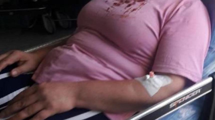 Temizlik Sırasında &Uuml;zerine Bozdolabı Devrilen Kadın Yaralandı