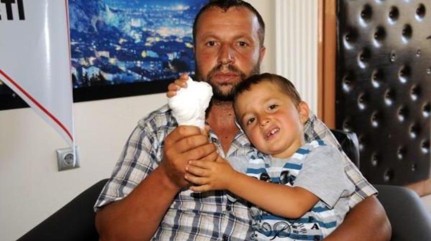 Dikecek Hastane Aranırken, 3 Yaşındaki &Ccedil;ocuk Parmağından Oldu