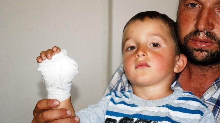 3 Yaşındaki &Ccedil;ocuğun Nacakla Kesilen Parmağı Yerine Dikilemedi