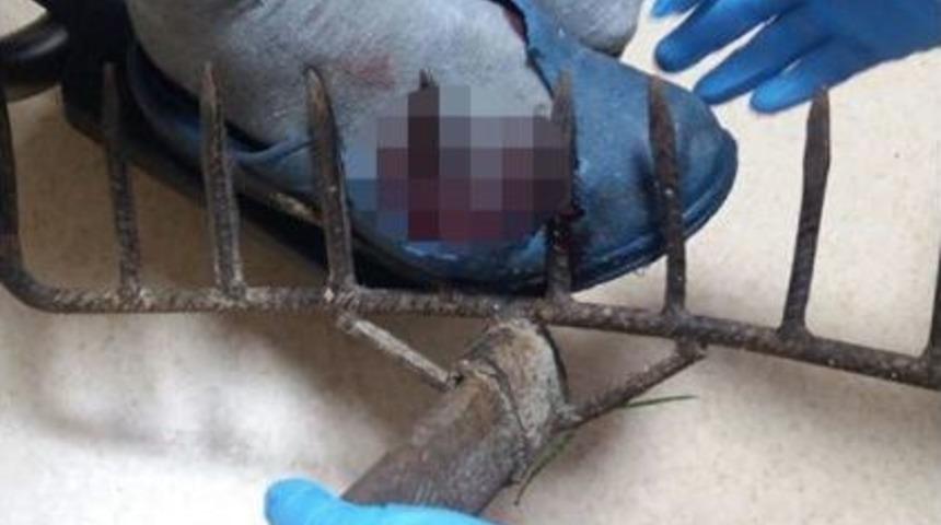 Ayağına Saplanan Tırmıkla Hastaneye Geldi