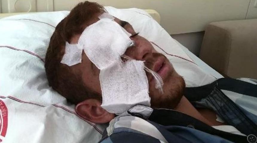 İnşaat &Ccedil;ivisi G&ouml;z&uuml;ne Delip, Beynine Saplandı