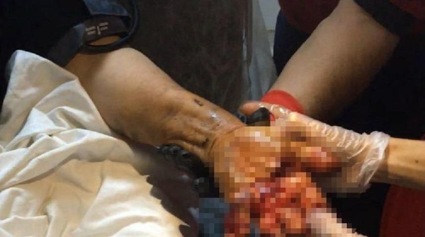 Eli Kıyma Makinesine Sıkışan Kadının Yardımına İtfaiye Yetişti