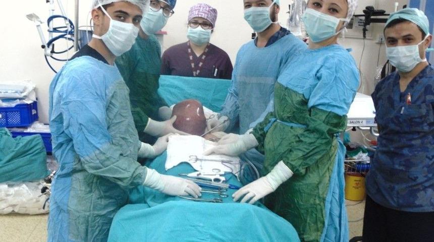 Karın Ağrısı Şikayetiyle Gitti, Rahminden 5 Kilo Ur Çıktı