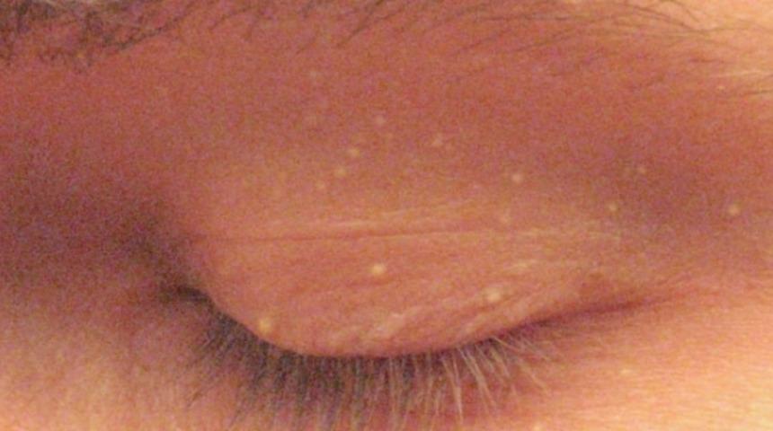 S&uuml;t Beneklerinden Kurtulmanın 11 Doğal Yolu