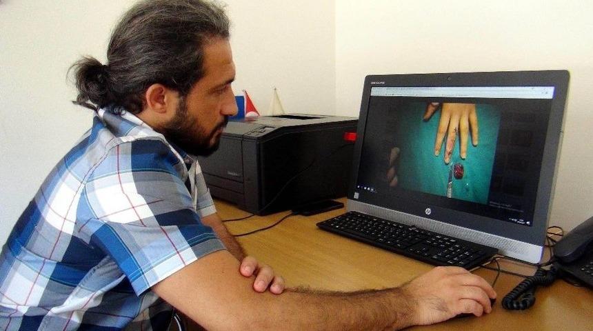 El Cerrahları Zamanla Yarışıyor