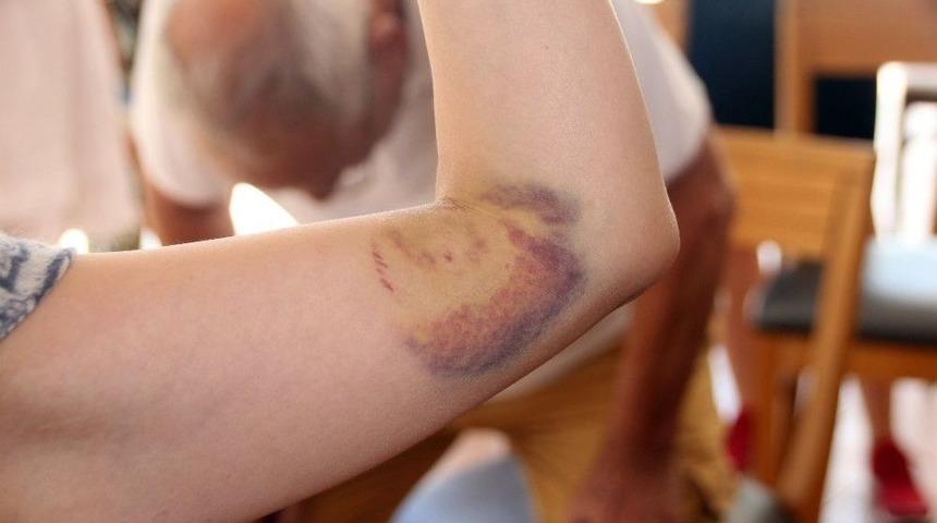 Caretta Caretta Bu Sefer Japonlara Saldırdı