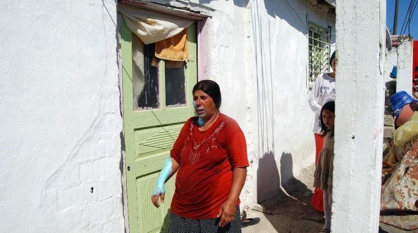 Yemek Yaparken Kendini Yaktı