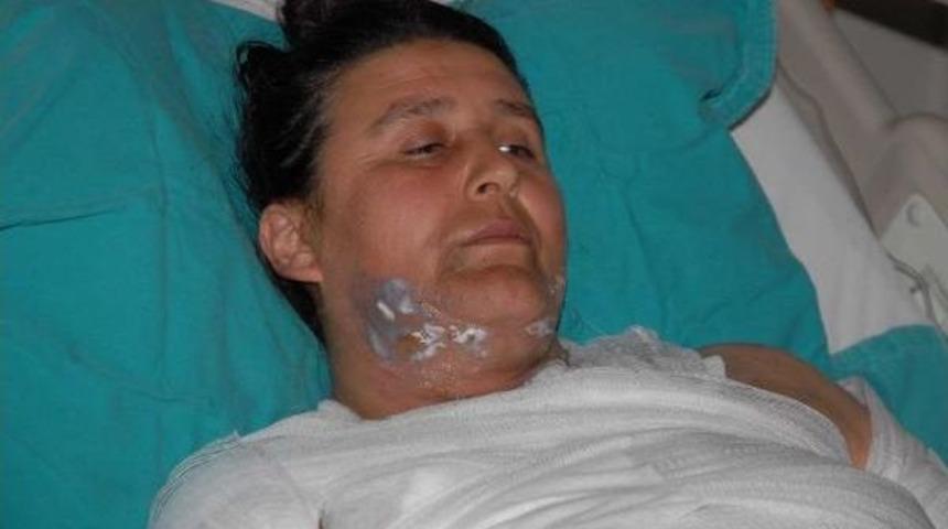 Kocasının Sevgilisi Tarafından Üzerine Sıcak Su Döküldü