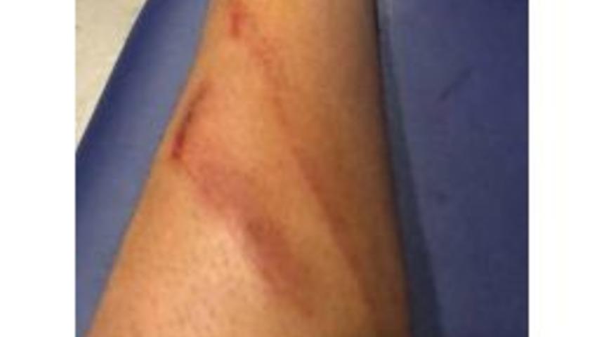 Ayta&ccedil; Kara&rsquo;dan Ma&ccedil;ın Hakemine Fotoğraflı Tepki