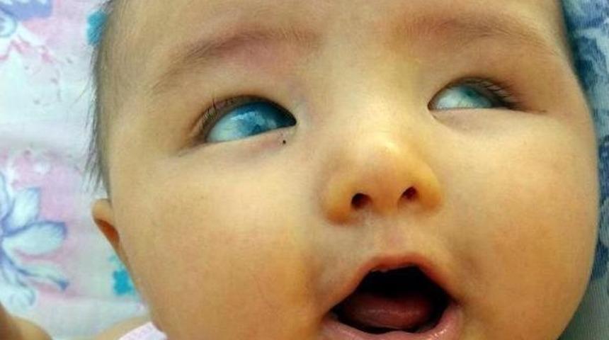 Ak Partili &Ouml;zt&uuml;rk, Masal Bebek I&ccedil;in Devreye Girdi