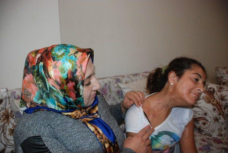 12 Yaşında, 13 Ameliyat Oldu G3