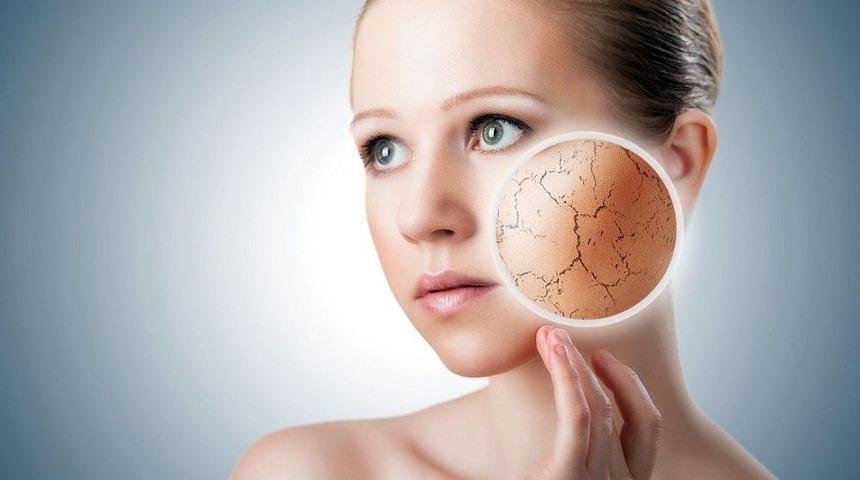 Cilt Kuruluğu &Ouml;nemsenmeli