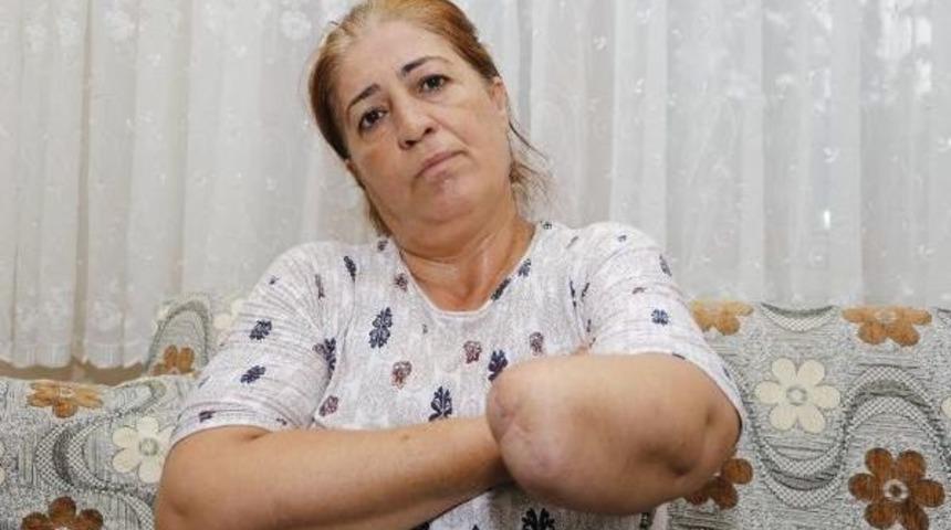 Elindeki Uyuşma I&ccedil;in Gittiği Hastanede Kolundan Oldu