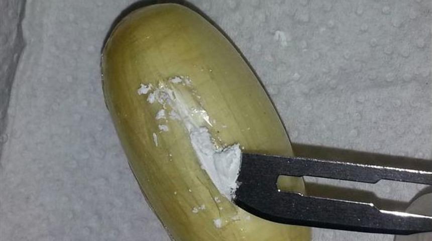 Brezilyalı Kuryenin Midesinden 59 Kaps&uuml;l Kokain &Ccedil;ıktı