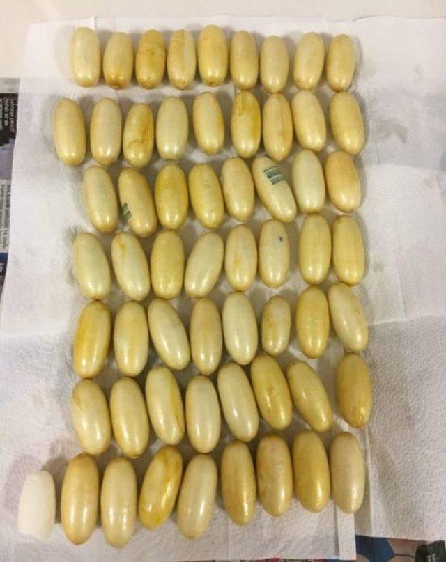 Brezilyalı Kadının Midesinde 59 Kaps&uuml;l Kokain 1