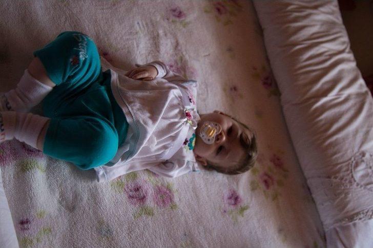 ’sağlıklı’ Dediler, Kolsuz Doğdu G3