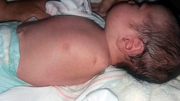 ’sağlıklı’ Dediler, Kolsuz Doğdu G4