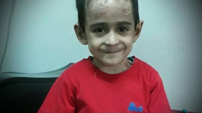 Kelebek Hastalığı &Ccedil;ocukların Hayatlarını &Ccedil;alıyor