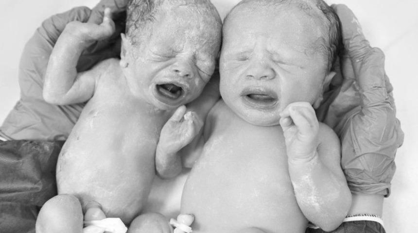 İzmir&rsquo;de Tıp Tarihine Ge&ccedil;ecek Olay