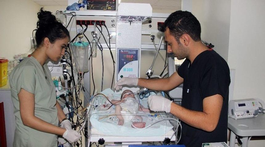 Suriyeli Bebeğin Kalbinin Yarısı &Ccedil;alışmıyor