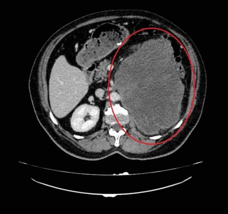Dünyada İkinci Kez Rastlanan Vaka Doktorları Bile Şaşırttı G1
