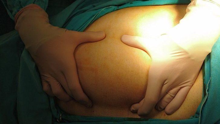 Dünyada İkinci Kez Rastlanan Vaka Doktorları Bile Şaşırttı G4